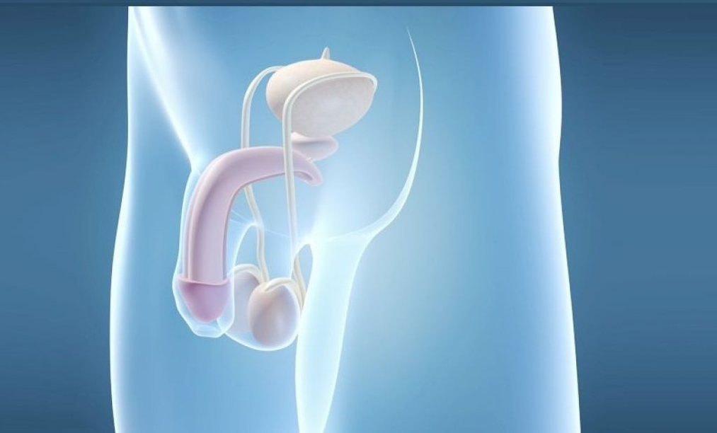 Имплантирането на протези е хирургичен метод за уголемяване на мъжкия пенис